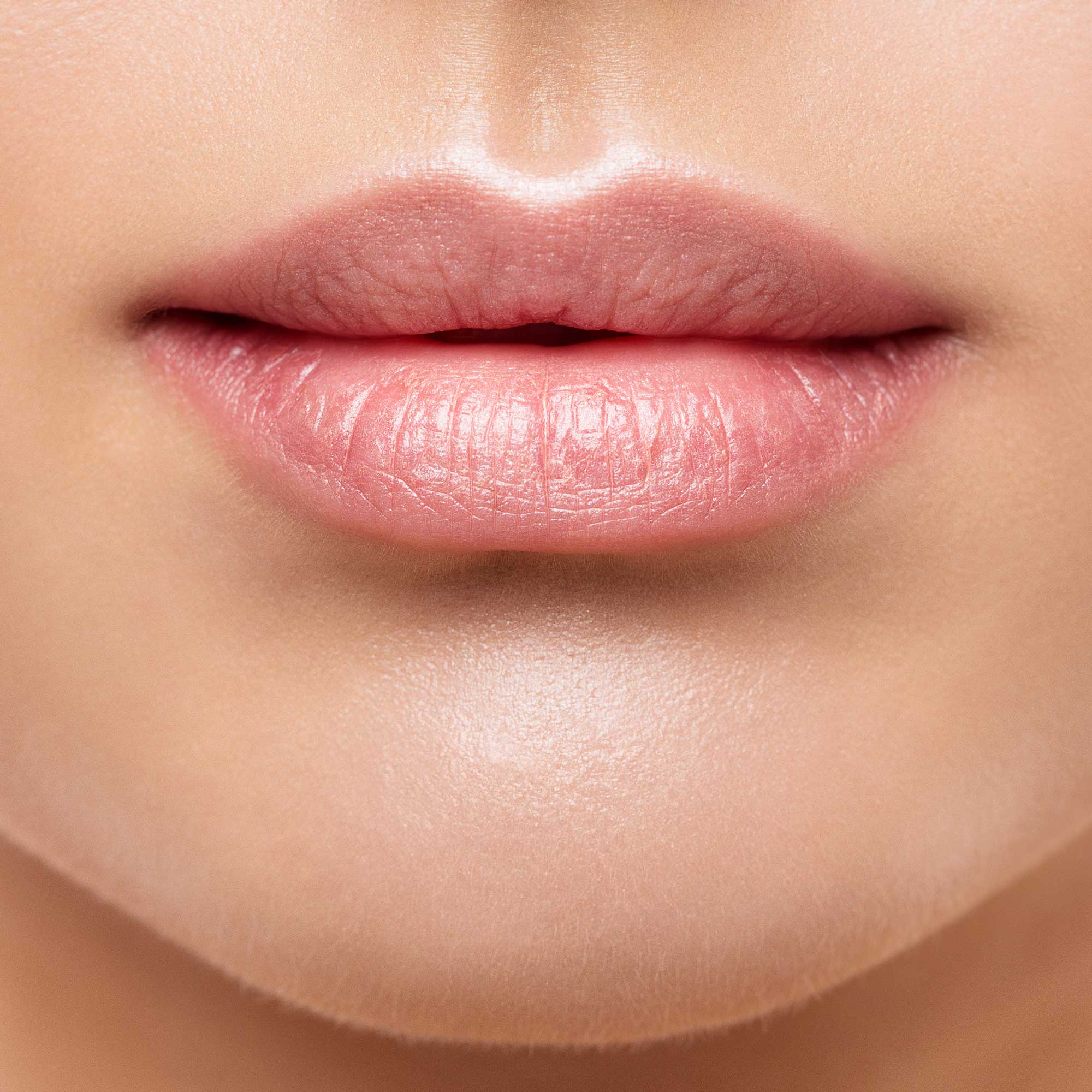 Dermal Fillers