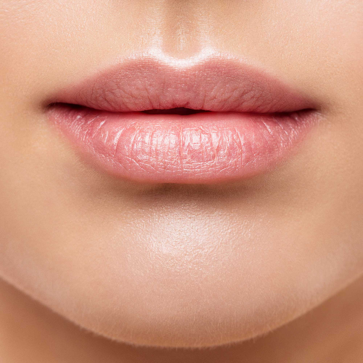 Dermal Fillers